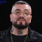 Guè Pequeno: il rapper milanese e la blefaroptosi che lo ha reso unico
